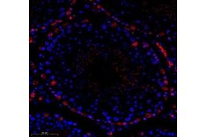 Immunofluorescence of paraffin embedded mouse testis using groucho (ABIN7075961) at dilution of 1:1000 (350x lens) (TLE1 anticorps)