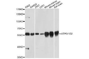 Western blot analysis of extracts of various cell lines, using ATP6V1B2 Antibody. (ATP6V1B2 anticorps  (AA 262-511))