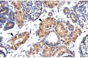 Human kidney; ZFPL1 antibody - middle region in Human kidney cells using Immunohistochemistry (ZFPL1 anticorps  (Middle Region))