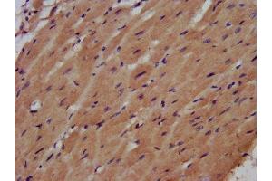 IHC image of ABIN7161246 diluted at 1:500 and staining in paraffin-embedded human heart tissue performed on a Leica BondTM system.