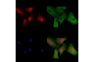 ABIN6260150 and ABIN6279147 staining  cells by IF/ICC. (ATXN7 anticorps  (Internal Region))
