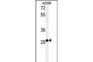 Western blot analysis in A2058 cell line lysates (35ug/lane). (C11orf46 anticorps  (C-Term))