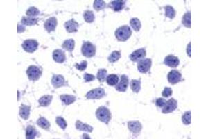 Anti-GPR45 antibody immunocytochemistry (ICC) staining of untransfected HEK293 human embryonic kidney cells. (GPR45 anticorps  (Cytoplasmic Domain))