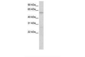 Image no. 1 for anti-Hypermethylated in Cancer 2 (HIC2) (N-Term) antibody (ABIN6736170) (HIC2 anticorps  (N-Term))