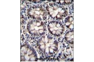 anti-C-terminal Binding Protein 2 (CTBP2) (AA 1-30), (N-Term) antibody