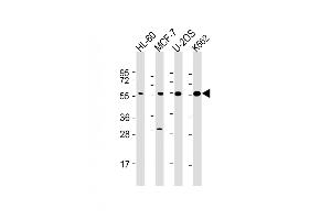All lanes : Anti-EI2BG Antibody at 1:2000 dilution Lane 1: HL-60 whole cell lysate Lane 2: MCF-7 whole cell lysate Lane 3: U-2OS whole cell lysate Lane 4: K562 whole cell lysate Lysates/proteins at 20 μg per lane. (EIF2B3 anticorps  (AA 110-452))