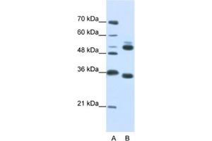 Western Blotting (WB) image for anti-WD Repeat Domain 6 (WDR6) antibody (ABIN2462385) (WDR6 anticorps)