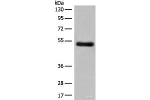 Western blot analysis of Human breast cancer tissue lysate using GK5 Polyclonal Antibody at dilution of 1:500 (GK5 anticorps)