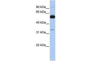 WB Suggested Anti-PHGDH Antibody Titration: 0. (PHGDH anticorps  (Middle Region))