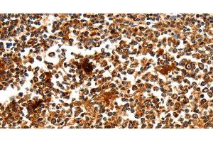 Immunohistochemistry of paraffin-embedded Human tonsil using MYOZ1 Polyclonal Antibody at dilution of 1:50