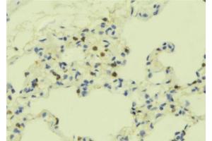 ABIN6273501 at 1/100 staining Mouse lung tissue by IHC-P. (ADCY3 anticorps  (C-Term))