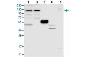 Western blot analysis of Lane 1: RT-4, Lane 2: U-251 MG, Lane 3: Human Plasma, Lane 4: Liver, Lane 5: Tonsil with ZSWIM5 polyclonal antibody . (ZSWIM5 anticorps)