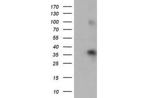 Western Blotting (WB) image for anti-Zinc Finger Protein 36, C3H Type, Homolog (Mouse) (ZFP36) antibody (ABIN1501406) (ZFP36 anticorps)