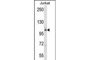 P4K2 Antibody (Center) (ABIN656275 and ABIN2845587) western blot analysis in Jurkat cell line lysates (35 μg/lane). (MAP4K2 anticorps  (AA 321-349))