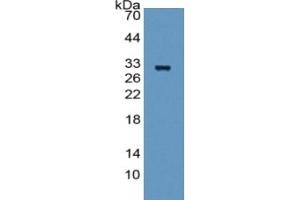 WB of Protein Standard: different control antibodies against Highly purified E. (FGA Kit ELISA)