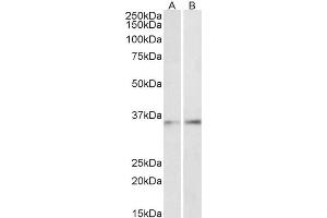 Image no. 1 for anti-CCAAT/enhancer Binding Protein (C/EBP), beta (CEBPB) (AA 68-81) antibody (ABIN5883747) (CEBPB anticorps  (AA 68-81))