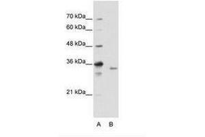 Image no. 2 for anti-Exosome Component 3 (EXOSC3) (C-Term) antibody (ABIN202145) (EXOSC3 anticorps  (C-Term))