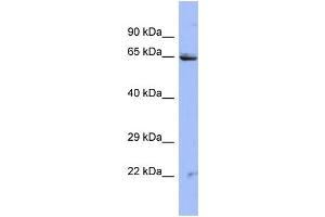 Host:  Rabbit  Target Name:  ZNF284  Sample Type:  HT1080 Whole cell lysates  Antibody Dilution:  1. (ZNF284 anticorps  (N-Term))