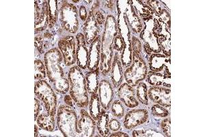Immunohistochemical staining of human kidney with COQ9 polyclonal antibody  shows strong cytoplasmic positivity in renal tubules. (COQ9 anticorps)