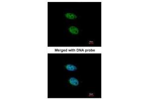 ICC/IF Image Immunofluorescence analysis of paraformaldehyde-fixed HeLa, using PRPS2, antibody at 1:200 dilution. (PRPS2 anticorps)