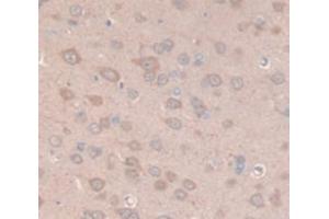 IHC-P analysis of Rat Tissue, with DAB staining. (Prolactin anticorps  (AA 30-226))