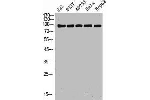 Western Blot analysis of 823 293T AD293 Hela HepG2 cells using NOXIN Polyclonal Antibody (C11orf82 anticorps  (Internal Region))