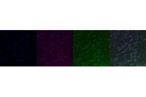 Immunohistochemistry (IHC) image for anti-Transient Receptor Potential Cation Channel, Subfamily C, Member 6 (TRPC6) antibody (ABIN7456173)