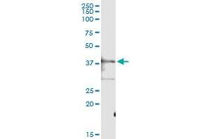 anti-Prostaglandin E Synthase 2 (PTGES2) (AA 1-377) antibody