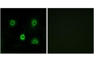 Immunofluorescence analysis of A549 cells, using ABHD6 Antibody. (ABHD6 anticorps  (AA 231-280))