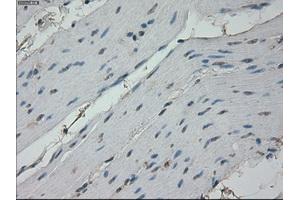 Immunohistochemical staining of paraffin-embedded colon tissue using anti-RPA2 mouse monoclonal antibody. (RPA2 anticorps)