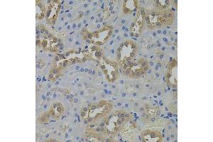 Immunohistochemistry of paraffin-embedded rat kidney using ARF1 antibody. (ARF1 anticorps)