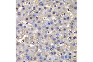 Immunohistochemistry (IHC) image for anti-Dihydrofolate Reductase (DHFR) (AA 1-187) antibody (ABIN3022228)