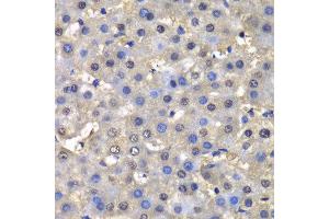 Immunohistochemistry (IHC) image for anti-Dihydrofolate Reductase (DHFR) (AA 1-187) antibody (ABIN3022228) (Dihydrofolate Reductase anticorps  (AA 1-187))