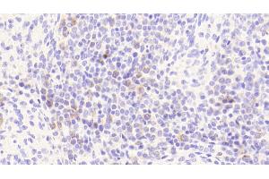 Detection of PRKAb1 in Human Spleen Tissue using Polyclonal Antibody to Protein Kinase, AMP Activated Beta 1 (PRKAb1)