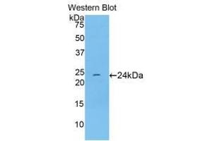 Western blot analysis of recombinant Rat TNNI1. (TNNI1 anticorps  (AA 1-187))