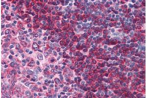 Human Tonsil: Formalin-Fixed, Paraffin-Embedded (FFPE)