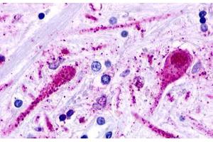 Image no. 1 for anti-Trace Amine Associated Receptor 2 (TAAR2) (Cytoplasmic Domain) antibody (ABIN1049380)