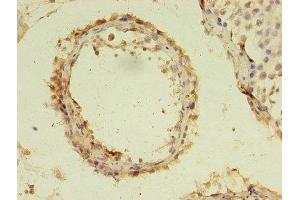 Immunohistochemistry of paraffin-embedded human testis tissue using ABIN7174767 at dilution of 1:100 (C19orf47 anticorps  (AA 1-281))