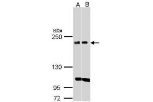 WB Image Sample(30 ug whole cell lysate) A:H1299 B:Raji , 5% SDS PAGE antibody diluted at 1:1000 (KIDINS220 anticorps  (C-Term))