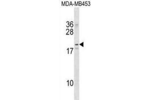 Western Blotting (WB) image for anti-Na+/K+ Transporting ATPase Interacting 2 (NKAIN2) antibody (ABIN2998903) (NKAIN2 anticorps)
