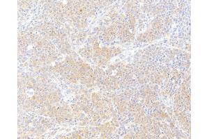 Immunohistochemistry (IHC) image for anti-Fatty Acid Synthase (FASN) (AA 2462-2511) antibody (ABIN7453707)