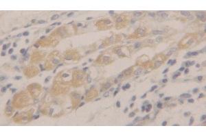 Detection of PRDX2 in Human Stomach Tissue using Polyclonal Antibody to Peroxiredoxin 2 (PRDX2) (Peroxiredoxin 2 anticorps  (AA 6-164))