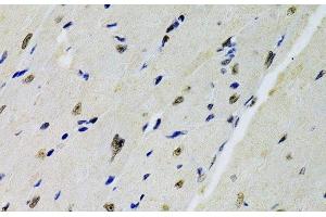 Immunohistochemistry of paraffin-embedded Mouse heart using DOK1 Polyclonal Antibody at dilution of 1:100 (40x lens). (DOK1 anticorps)