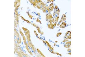 Immunohistochemistry of paraffin-embedded mouse heart using COL9A3 antibody at dilution of 1:100 (40x lens). (COL9A3 anticorps)