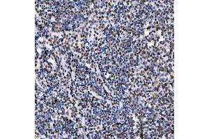 IHC analysis of SAE1 using anti-SAE1 antibody (ABIN7601346). (SAE1 anticorps  (AA 33-299))