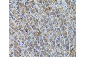 Immunohistochemistry of paraffin-embedded Mouse stomach using UBE2A Polyclonal Antibody (UBE2A anticorps)