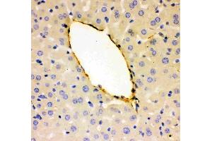 Anti-VWF Picoband antibody, (ABIN3042349), IHC(P)IHC(P): Mouse Liver Tissue (VWF anticorps  (AA 1304-1452))