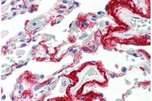 anti-TIMP Metallopeptidase Inhibitor 3 (TIMP3) (AA 170-188) antibody