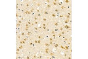 Immunohistochemistry of paraffin embedded mouse brain using PGBD5 (ABIN7075082) at dilution of 1:2000 (400x lens)