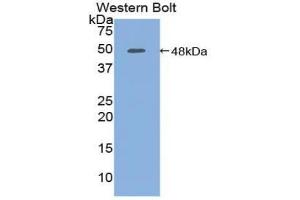 Western blot analysis of the recombinant protein. (PCOLCE anticorps  (AA 38-449))